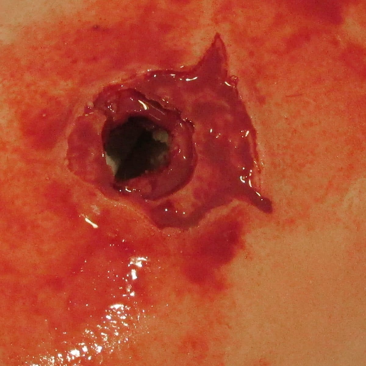 True Clot Hemorrhage Training Kit